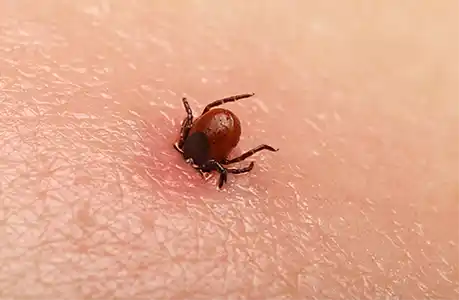 a tick burrowing into a person's skin - keep pests away from your home with florida pest control