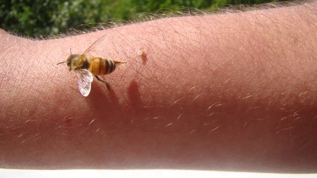 bee : apis mellifera.
treatment by honey bee sting.